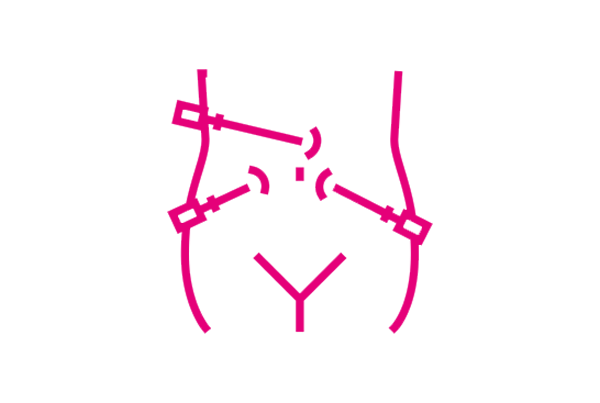 Minimally Invasive Gynaecology
