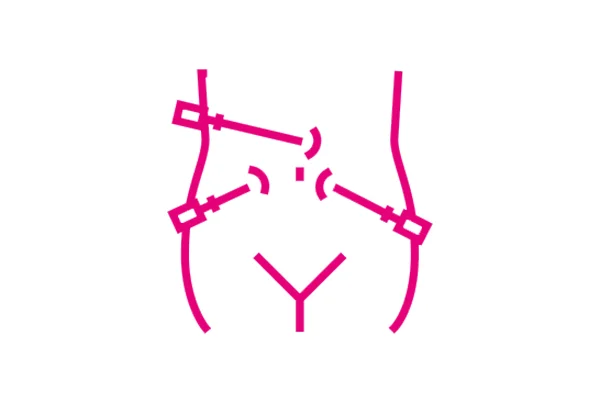 Minimally Invasive Gynaecology