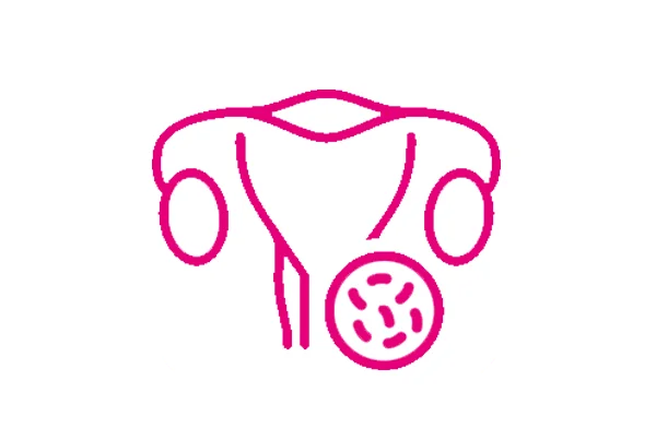 Vaginitis